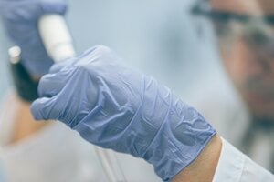 Deformuje penis či konečník. Narastá počet prípadov rakoviny spôsobenej HPV vírusom