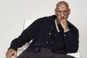 Podľa Separa je v západnej Európe fašizmus, no u nás sa dá všetko. Markíza dáva od tvrdení ruky preč