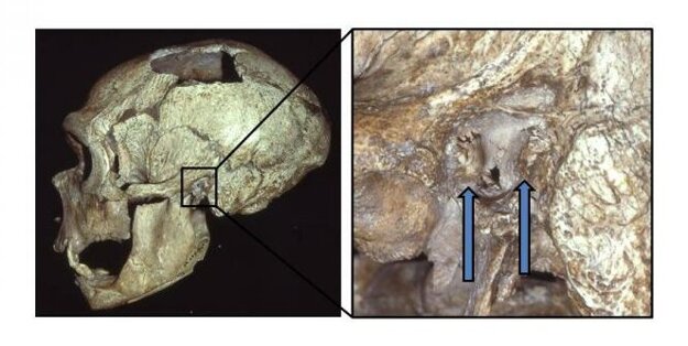 Záber vpravo ukazuje výrastky na kostiach pri ľavom zvukovode lebky neandertálca.