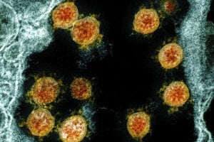 Pod elektrónovým mikroskopom je nový typ koronavírusu SARS-CoV-2 (oranžová farba), ktorý izolovali z tela pacienta v americkom meste Fort Detrick.
