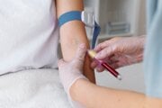 Správny pomer tekutej a pevnej zložky zabezpečí ľudovo povedané  správnu hustotu, a teda si krv plní svoju základnú úlohu okysličovania organizmu, výživy a ochrany.
