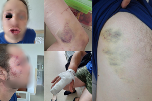 Inšpekcia stíha policajta. Napadol mladíka, ktorý žiadal o pomoc, keď myslel na samovraždu