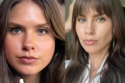 Influencerky si samodiagnostikujú "kortizolovú tvár".