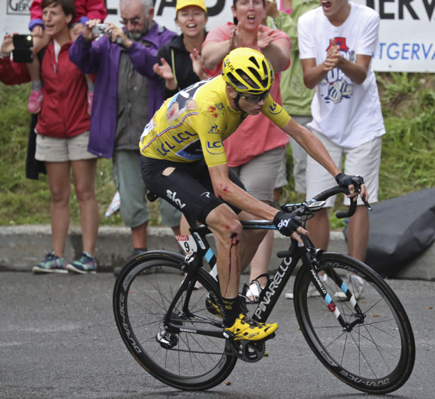Po páde má Chris Froome odreniny na lakti, kolene aj chrbáte.