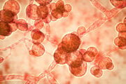 Je ťažké ju správne diagnostikovať, pretože bežné laboratórne testy si ju môžu pomýliť s inými druhmi kvasiniek, čo komplikuje liečbu.