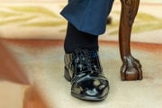 Ľavé chodidlo a opuchnutý členok prezidenta Donalda Trumpa.