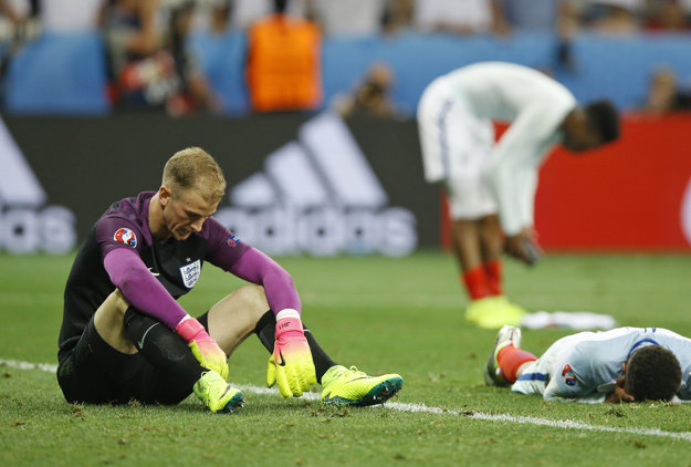 Joe Hart (vľavo) na Eure sklamal.