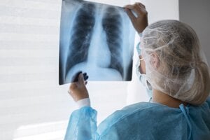 V Bojniciach hospitalizovali deväť ľudí s rovnakými príznakmi ochorenia pľúc nejasného pôvodu