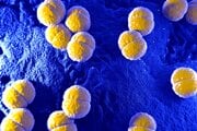 Baktéria Neisseria meningitidis, ktorá spôsobuje meningokokové infekcie.