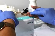 Preventívne skríningové vyšetrenie pečene vo vzdelávacom centre EDUKA vo FNsP F.D. Roosevelta Banská Bystrica.