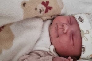 Nutne potrebuje transplantáciu detskej žľazy. Inak päťmesačné dievča zomrie