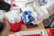 Antigénové testovanie na Covid-19.