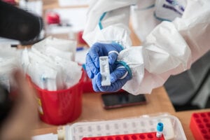 Antigénové testovanie na Covid-19.