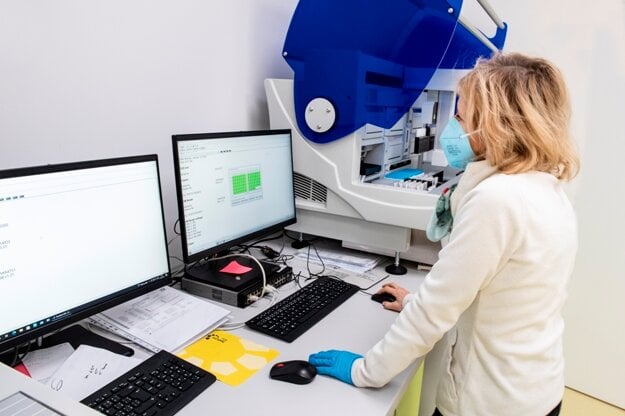 Unilabs Slovensko revealed the results of a research on the levels of antibodies after recovering from Covid.