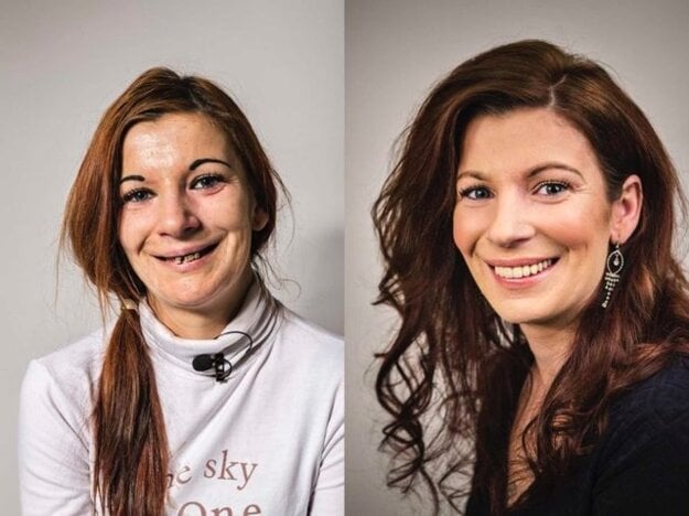  (zdroj: Schill Dental Clinic, Boris Németh)